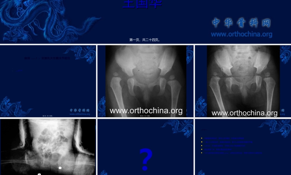 2022年医学专题—第三篇：DDH相关病例讨论资料(1).ppt