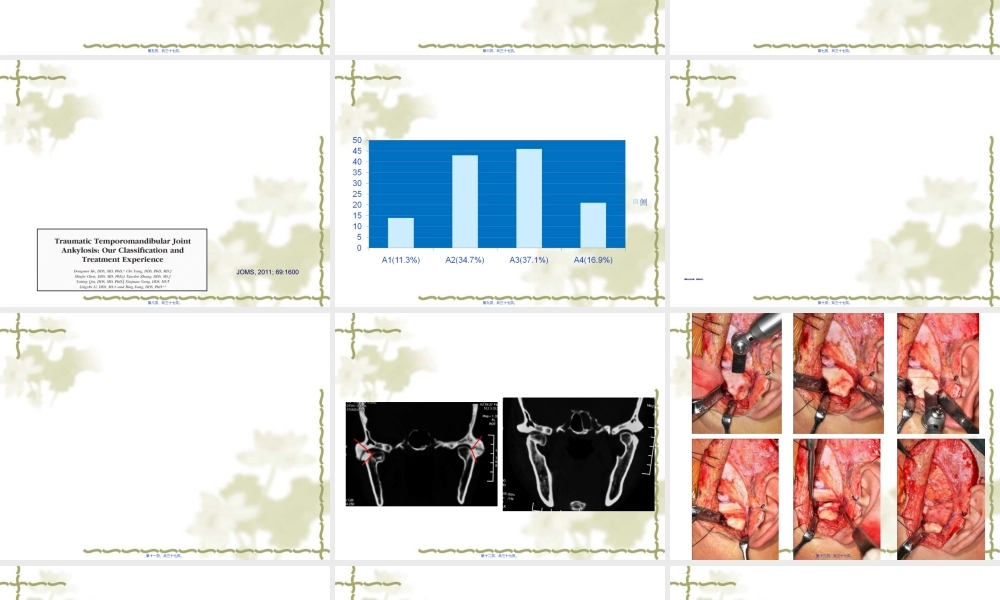 2022年医学专题—第四节-杨驰-颞下颌关节强直的诊治经验(1).ppt