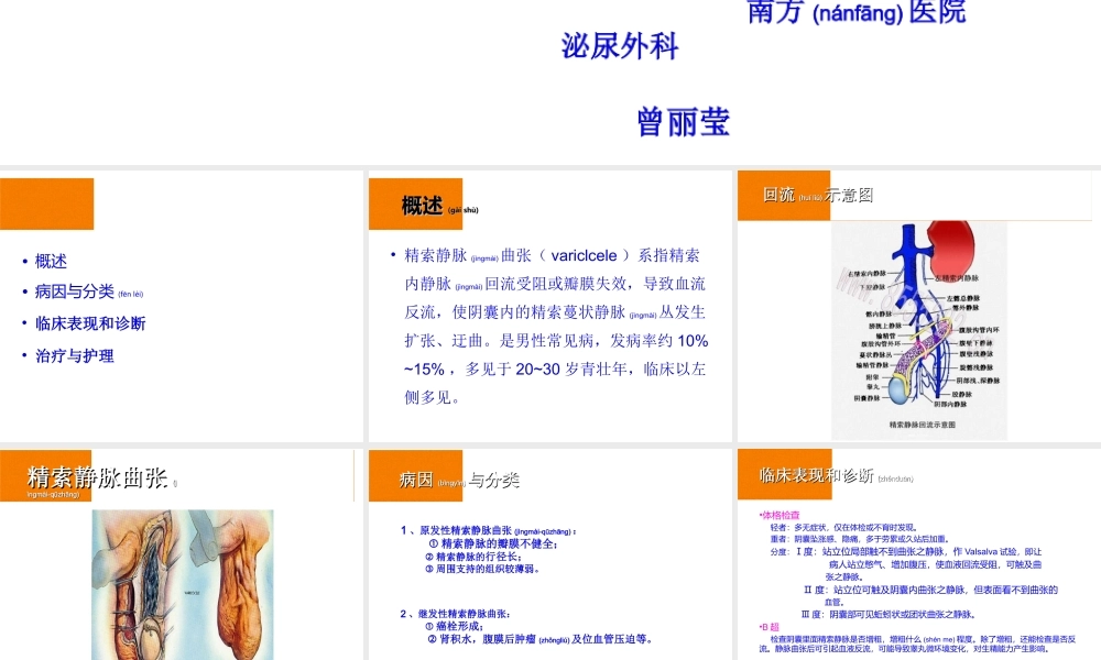 2022年医学专题—精索静脉曲张及胡桃夹综合征(1).ppt