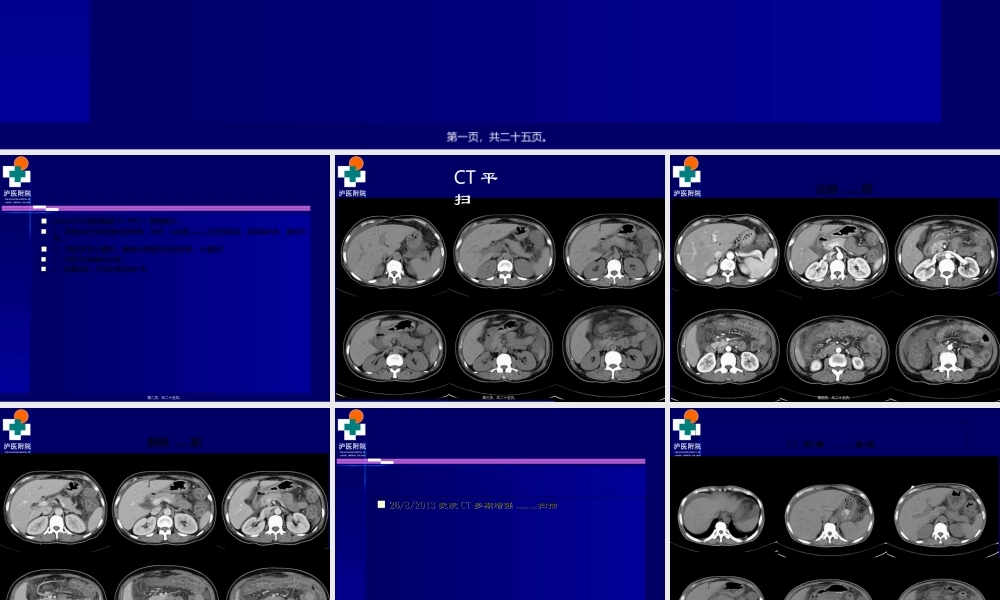 2022年医学专题—系统性红斑狼疮病例(1).ppt