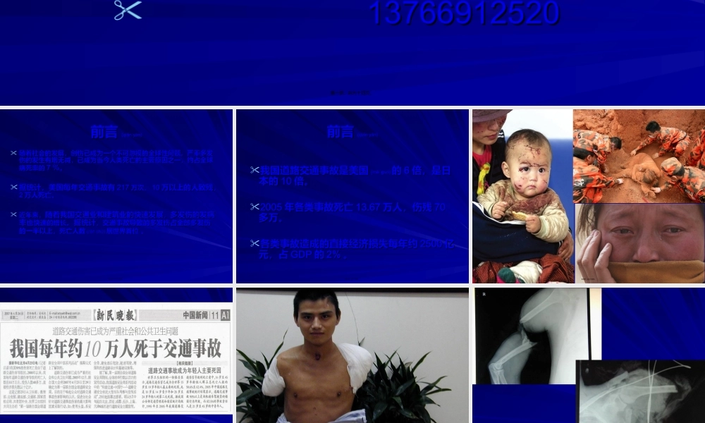 2022年医学专题—肘关节脱位伴骨折PPT2(1).ppt