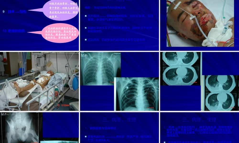 2022年医学专题—肘关节脱位伴骨折PPT2(1).ppt