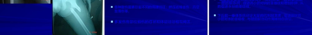 2022年医学专题—肘关节脱位伴骨折PPT2(1).ppt