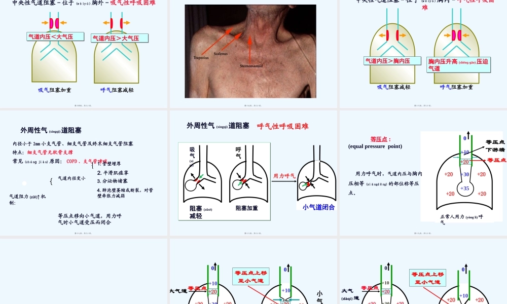 2022年医学专题—肺功能不全(1).pptx