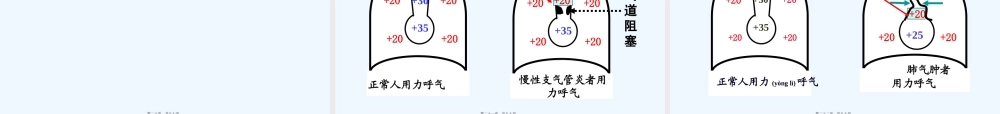 2022年医学专题—肺功能不全(1).pptx