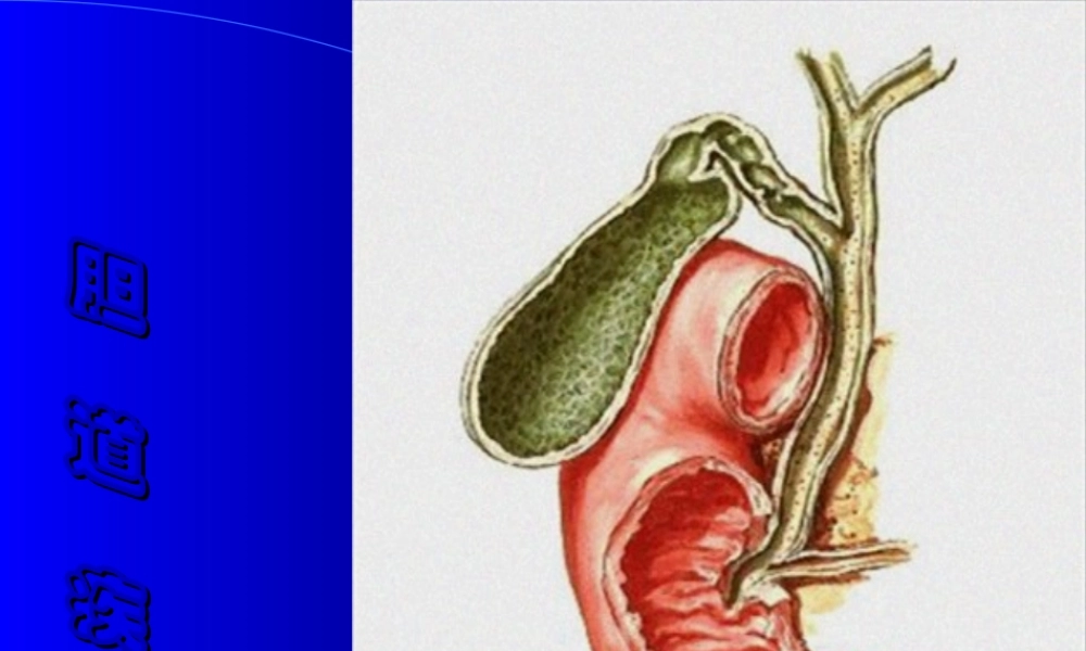 2022年医学专题—胆囊穿孔(1).ppt