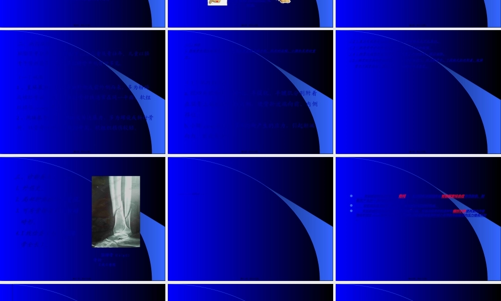 2022年医学专题—胫腓骨干骨折-红软基地(1).ppt