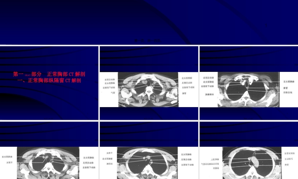 2022年医学专题—正常胸部CT(1).ppt