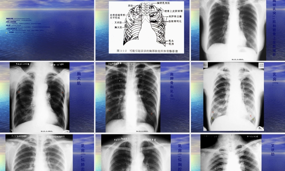 2022年医学专题—第一节、呼吸系统X线正常及异常影像(2学时)(1).ppt