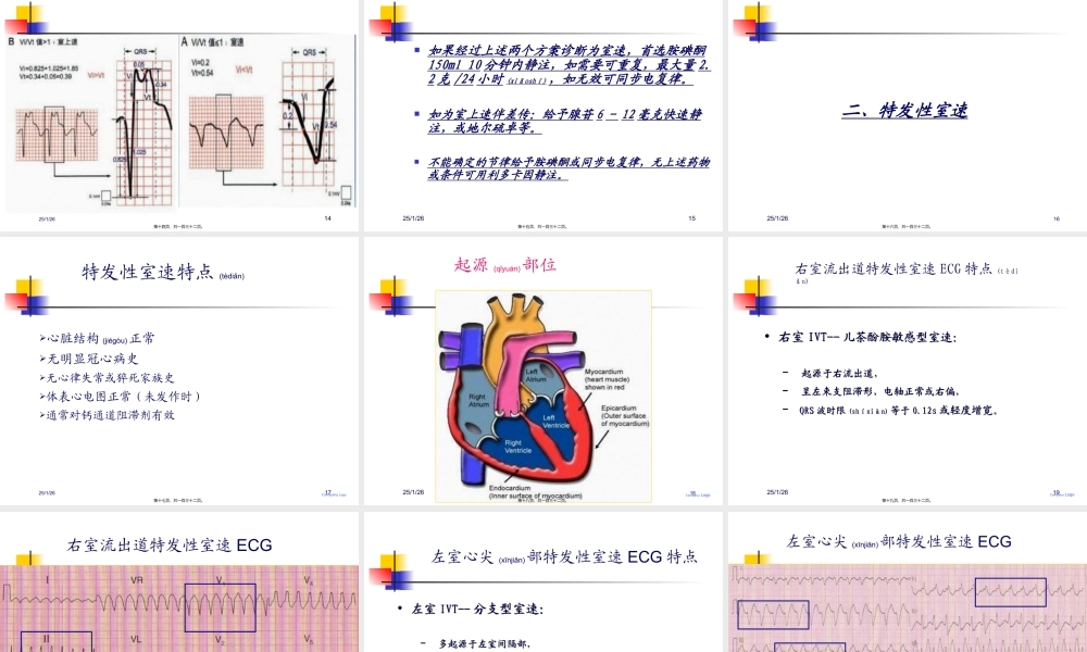 2022年医学专题—特殊心电图现象在急诊中的快速识别与处理.(1).ppt