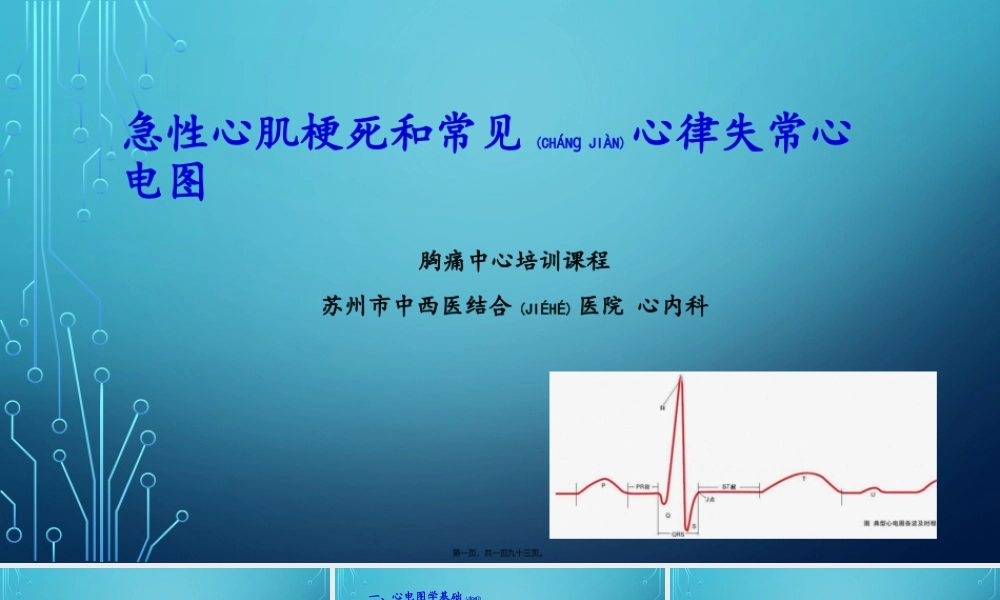 2022年医学专题—急性心肌梗死和常见心律失常心电图(1).pptx