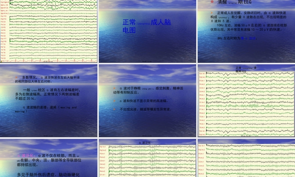 2022年医学专题—脑电图基础知识及判读..(1).ppt