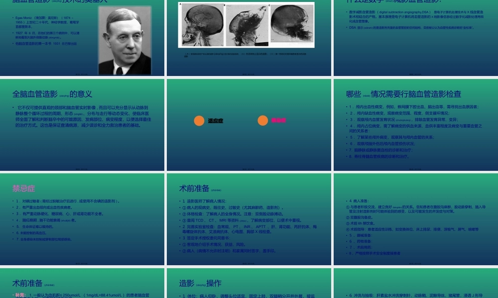 2022年医学专题—脑血管造影(1).pptx