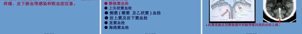 2022年医学专题—脑静脉系统血栓形成.简介(1).ppt