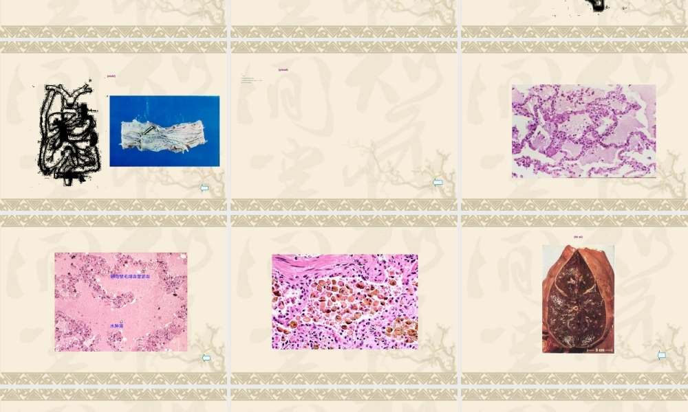 2022年医学专题—血液循环障碍-PPT文档(1).ppt