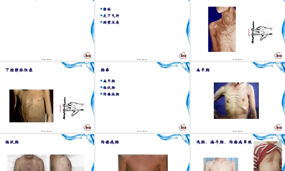 健康评估-胸部检查(理论).pptx