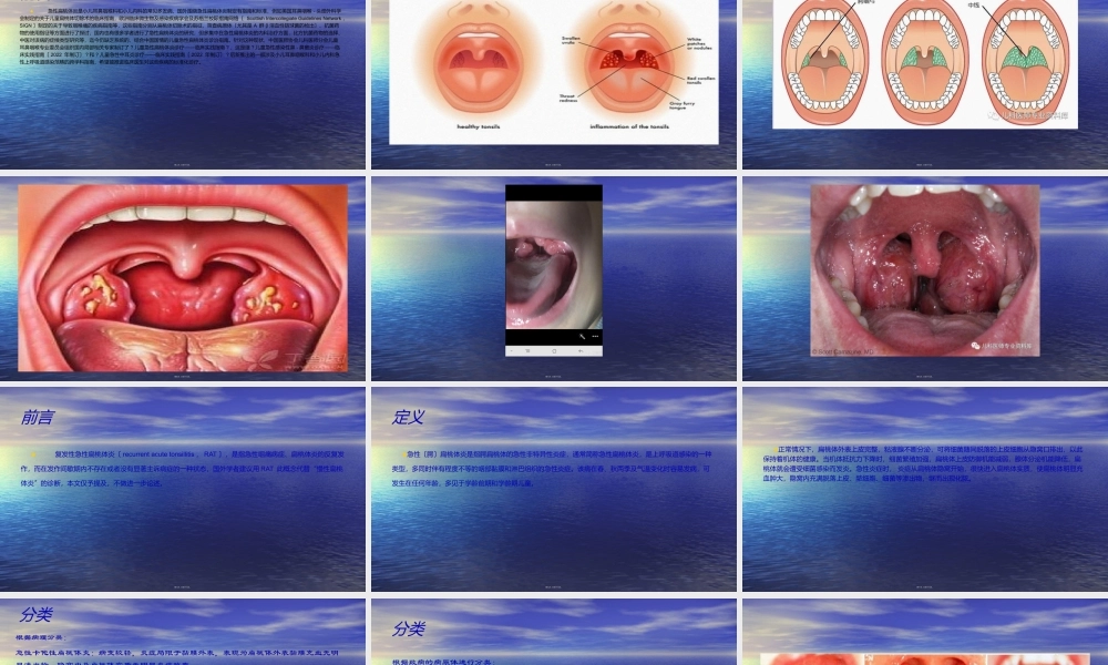 儿童急性扁桃体炎诊疗.ppt