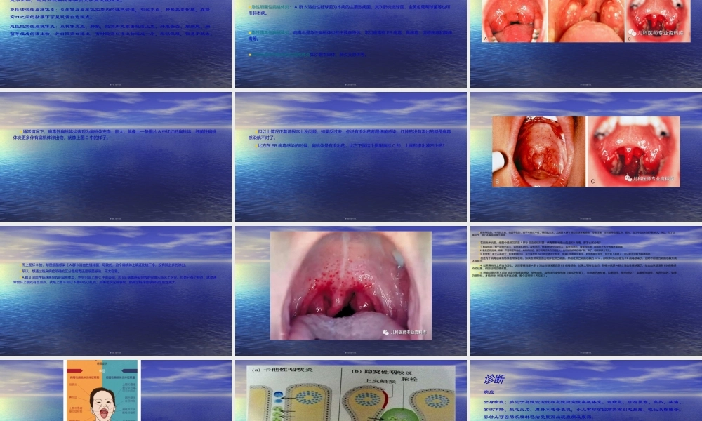 儿童急性扁桃体炎诊疗.ppt