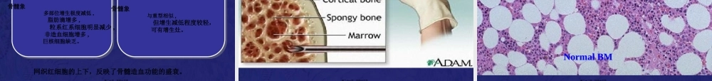 再生障碍性贫血教学PPT.pptx
