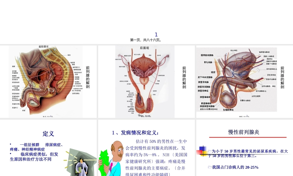 前-列-腺-炎综合征(张志超).pptx