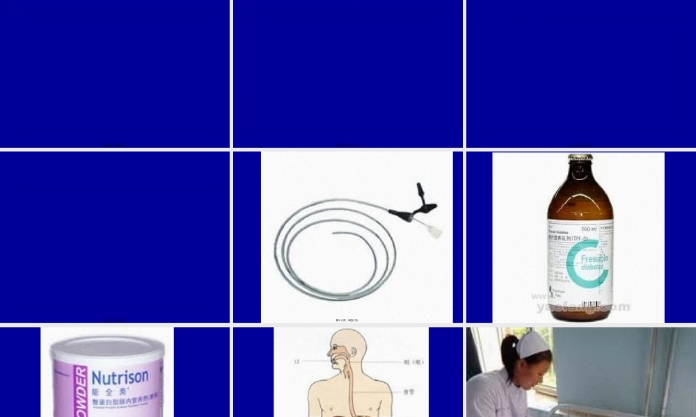 外科病人的营养代谢-河南大学淮河医院.pptx