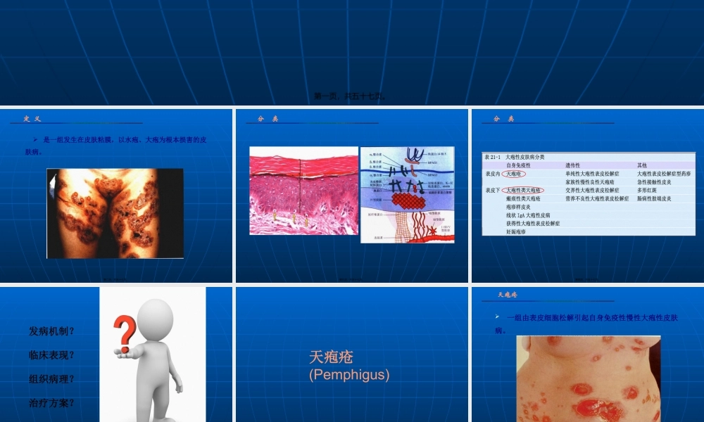 大疱性皮肤病.pptx
