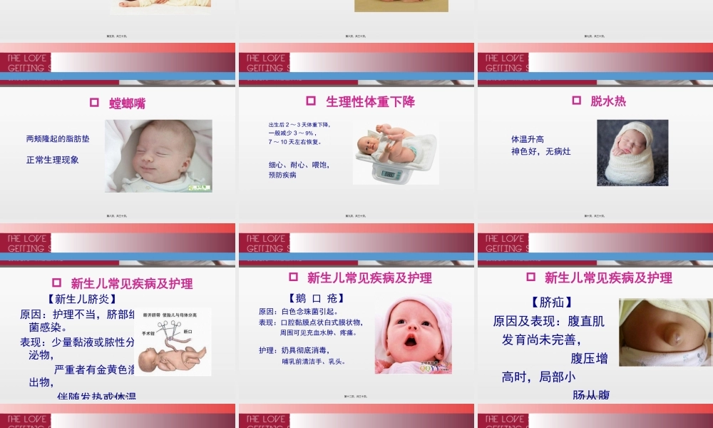 婴儿常见症状识别与处理.pptx