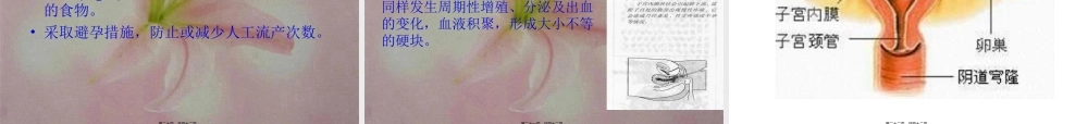 2022年医学专题—-4-妇科病(1).ppt