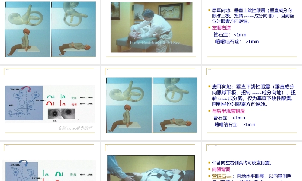 2022年医学专题—BPPV诊治(1).ppt