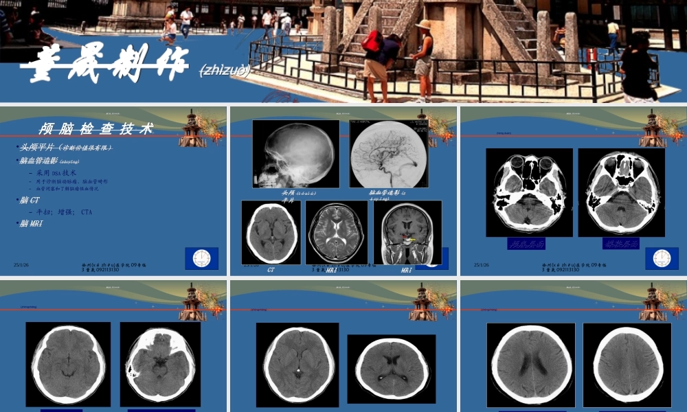 2022年医学专题—CT-MRI颅脑影像看片(1).ppt