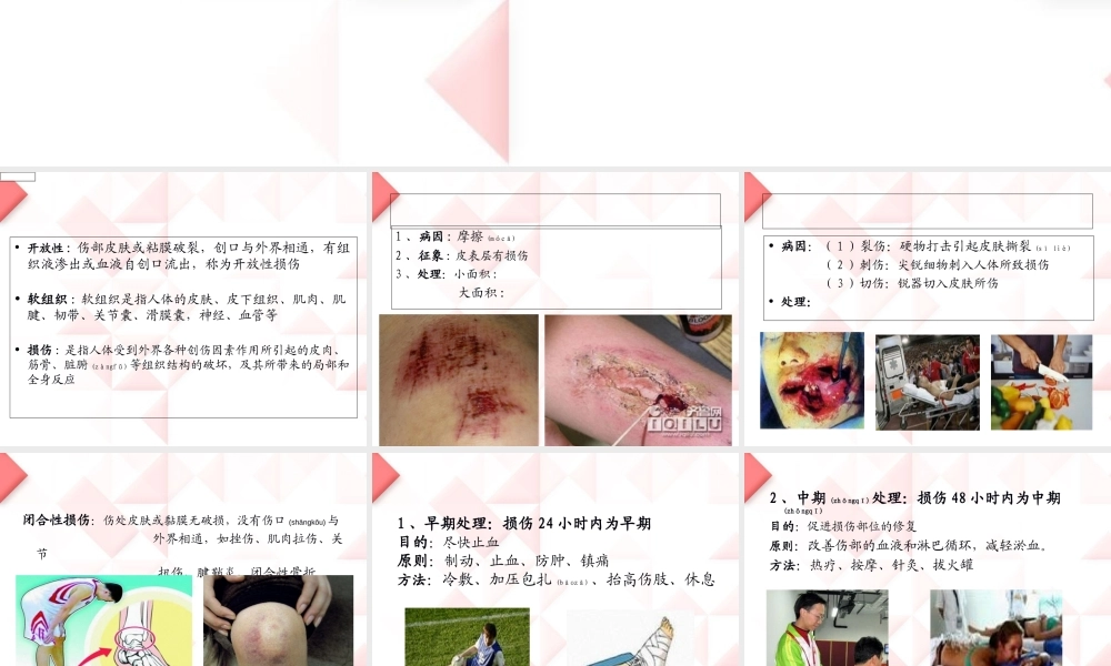 2022年医学专题—[资料]运动中常见损伤的理和急救(1).ppt