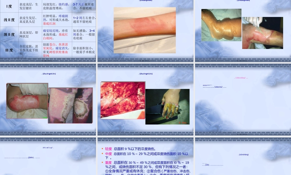 2022年医学专题—七月份烧伤急救与创面处理(1).ppt