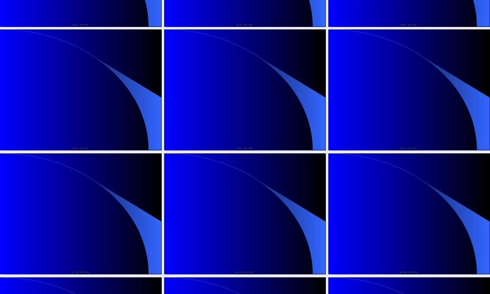 2022年医学专题—上肢骨折(中英文).ppt