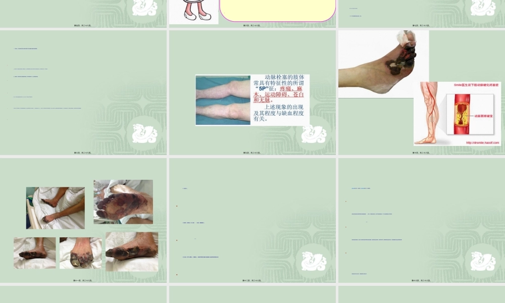 2022年医学专题—下肢动脉血栓相关知识讲述.ppt