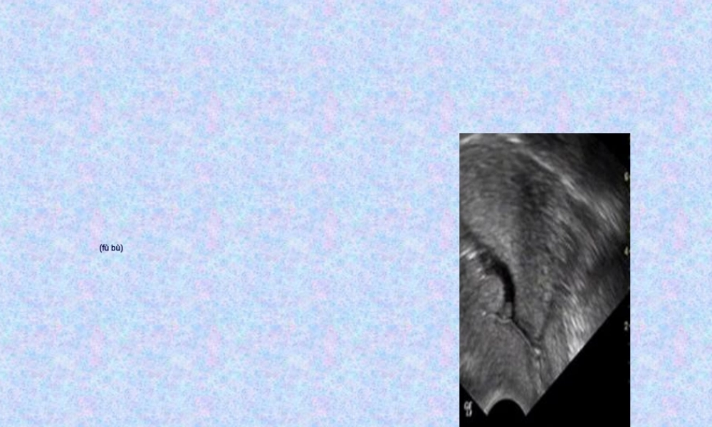 2022年医学专题—住院医师规培结业-腹部超声判读.ppt