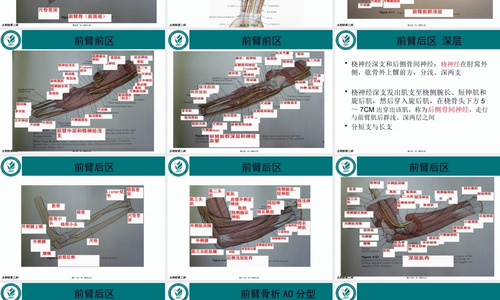 前臂骨折.pptx