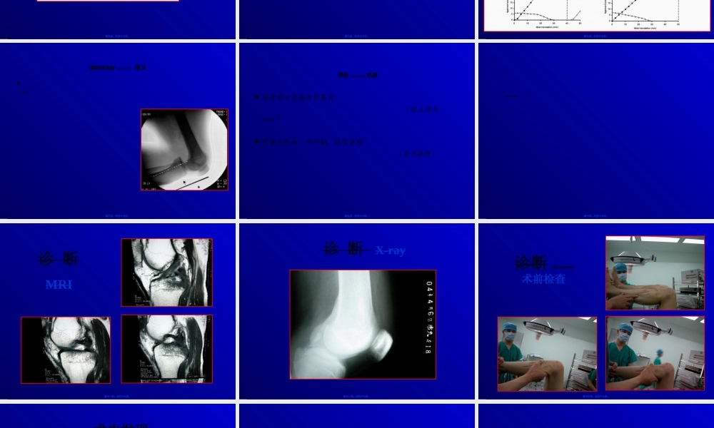 2022年医学专题—关节镜下的后交叉韧带重建术.ppt