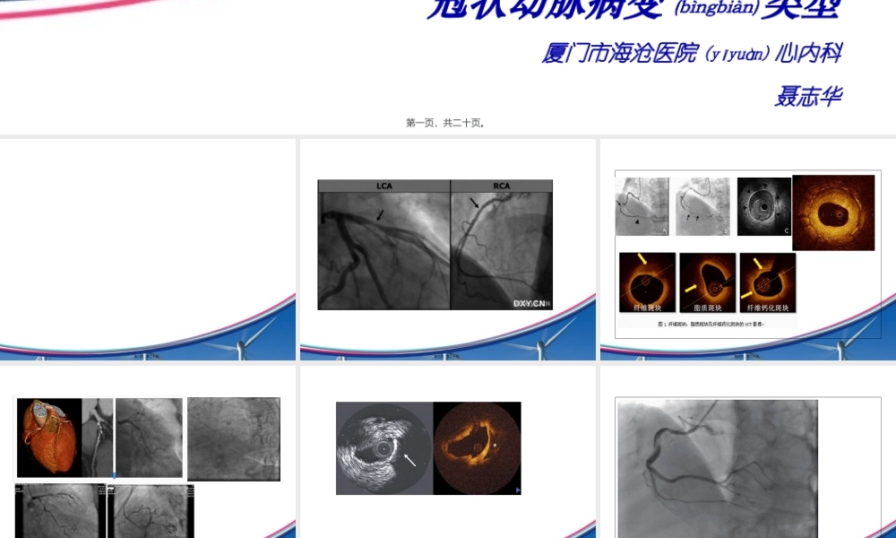 2022年医学专题—冠状动脉病变类型.ppt