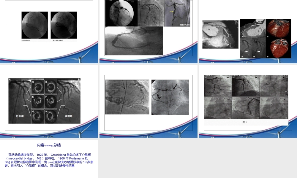 2022年医学专题—冠状动脉病变类型.ppt