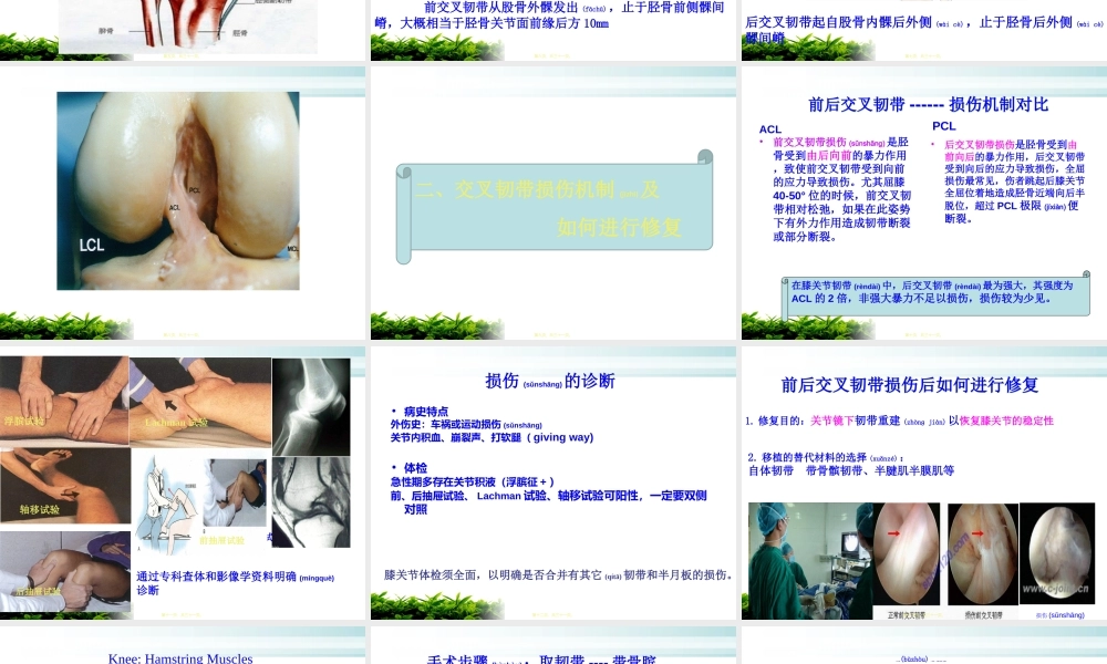 2022年医学专题—前后交叉韧带术后功能锻炼.ppt