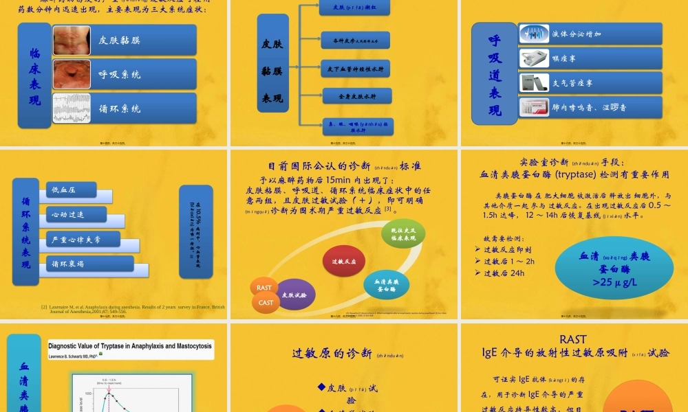 2022年医学专题—围术期过敏反应及其处理.pptx