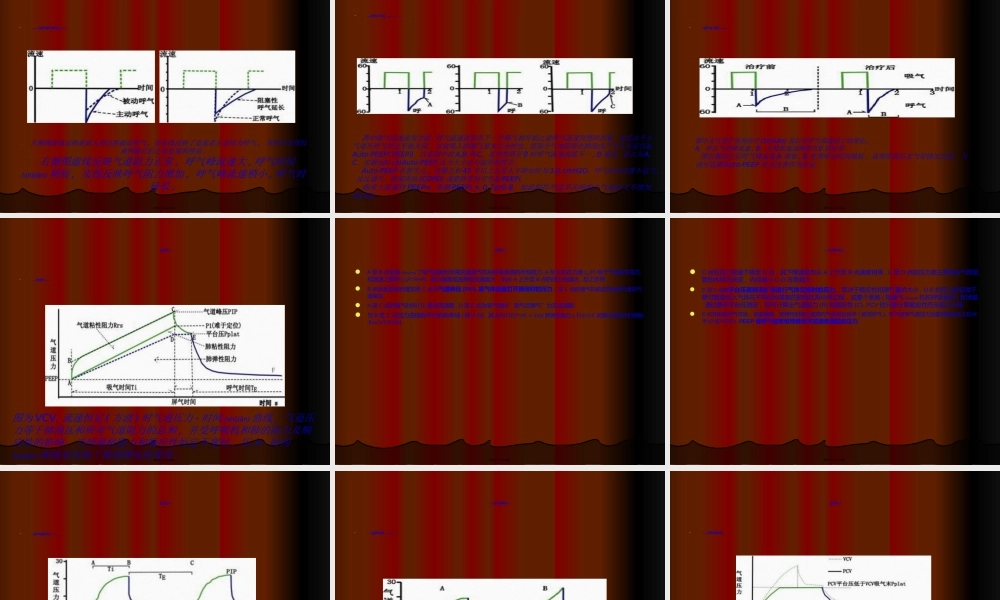 2022年医学专题—基础呼吸机波形分析.ppt