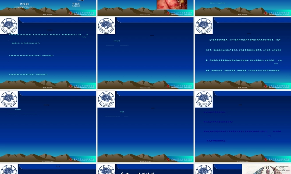 2022年医学专题—外科休克(推荐).ppt