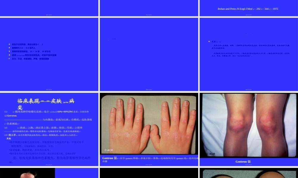 2022年医学专题—多发性肌炎&皮肌炎.ppt