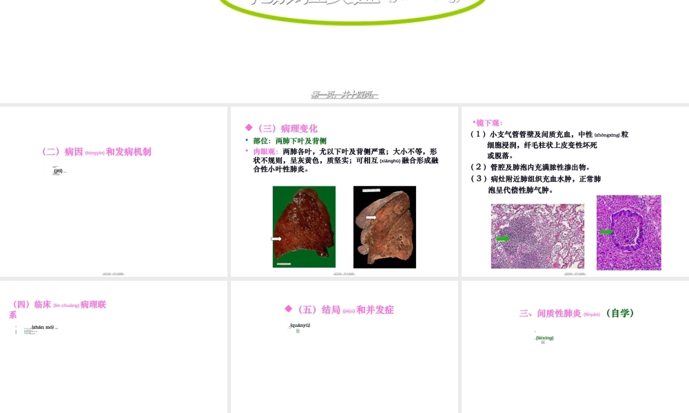 2022年医学专题—大叶性肺炎、小叶性肺炎、间质性肺炎(下部分)(1).ppt