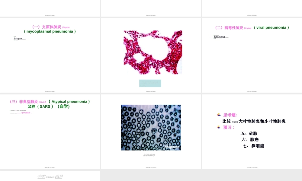 2022年医学专题—大叶性肺炎、小叶性肺炎、间质性肺炎(下部分)(1).ppt