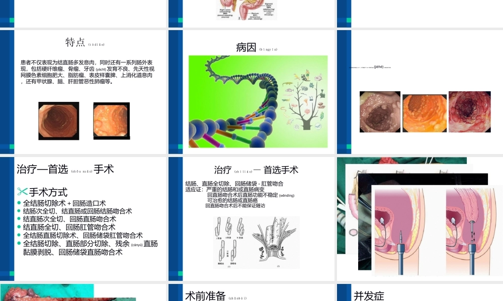 2022年医学专题—家族性结肠息肉病.ppt