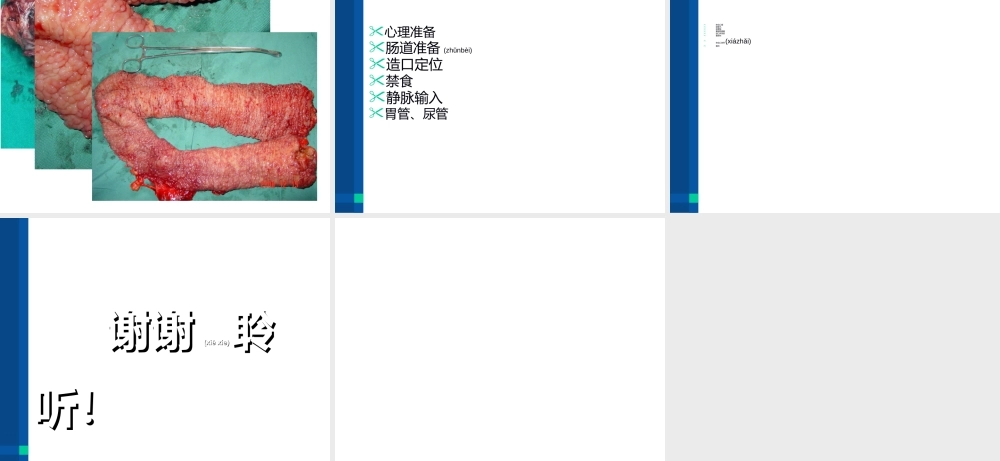 2022年医学专题—家族性结肠息肉病.ppt