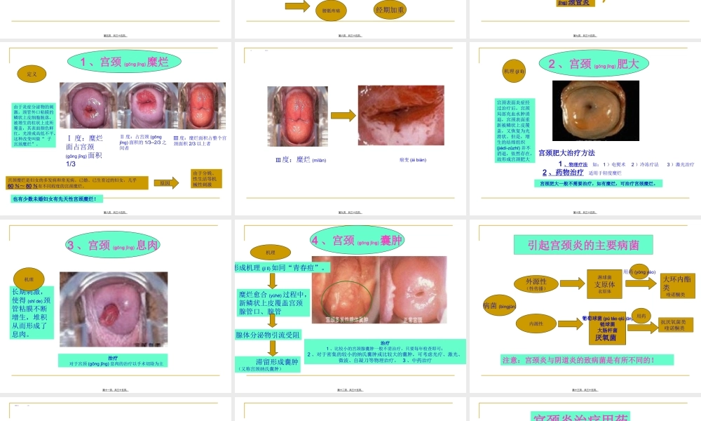 2022年医学专题—宫颈炎、副本炎、盆腔炎.ppt