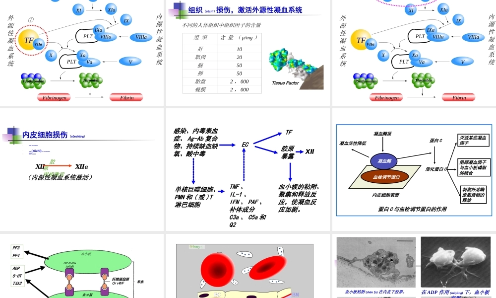 2022年医学专题—弥散性血管内凝血DIC.ppt